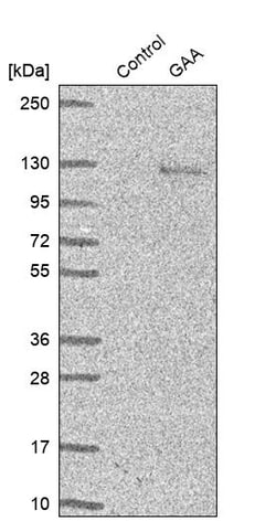 Invitrogen LYAG Polyclonal Antibody 100 &mu;L; Unconjugated:Antibodies,