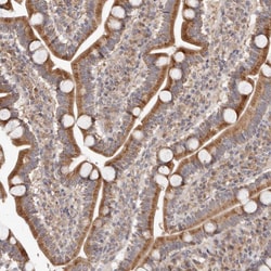 Apolipoprotein L6 Polyclonal Antibody:Antibodies, Polyclonal