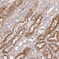 Apolipoprotein L6 Polyclonal Antibody:Antibodies, Polyclonal