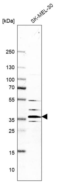 Invitrogen V-ATPase E1 Polyclonal Antibody 100 &mu;L | Buy Online | Invitrogen&trade; | Fisher Scientific
