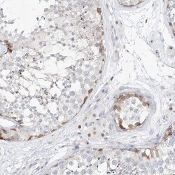 Invitrogen NHP2L1 Polyclonal Antibody 100 &mu;L; Unconjugated:Antibodies,