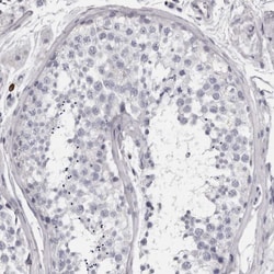 Invitrogen Granzyme H Polyclonal Antibody 100 &mu;L; Unconjugated:Antibodies,