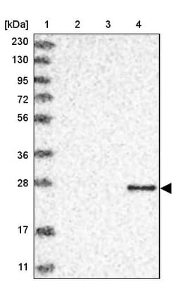 Invitrogen Granzyme H Polyclonal Antibody 100 &mu;L | Buy Online | Invitrogen&trade; | Fisher Scientific