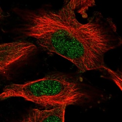 AMD1 Polyclonal Antibody:Antibodies, Polyclonal