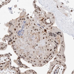 AMD1 Polyclonal Antibody:Antibodies, Polyclonal