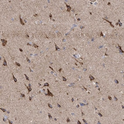 Invitrogen ITM2B Polyclonal Antibody 100 &mu;L; Unconjugated:Antibodies,