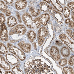 Invitrogen ITM2B Polyclonal Antibody 100 &mu;L; Unconjugated:Antibodies,