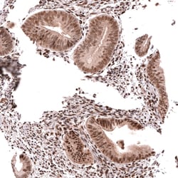 HOXA5 Polyclonal Antibody:Antibodies, Polyclonal