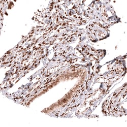 HOXA5 Polyclonal Antibody:Antibodies, Polyclonal