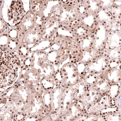 HOXA5 Polyclonal Antibody:Antibodies, Polyclonal