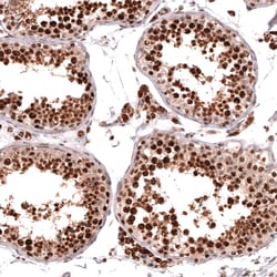 HOXA5 Polyclonal Antibody:Antibodies, Polyclonal