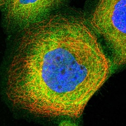 Invitrogen PIP5K1A Polyclonal Antibody 100 &mu;L; Unconjugated:Antibodies,