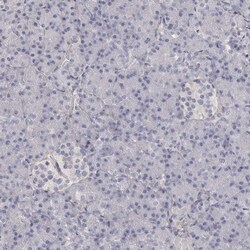 Invitrogen COL6A1 Polyclonal Antibody 100 &mu;L | Buy Online | Invitrogen&trade; | Fisher Scientific