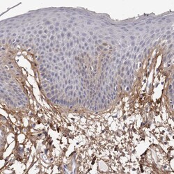 Invitrogen COL6A1 Polyclonal Antibody 100 &mu;L | Buy Online | Invitrogen&trade; | Fisher Scientific