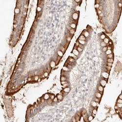 MEP1A Polyclonal Antibody:Antibodies, Polyclonal