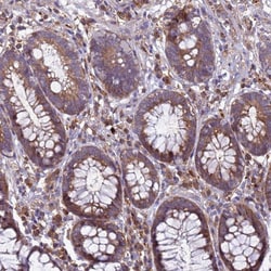 Invitrogen RNF215 Polyclonal Antibody 100 &mu;L; Unconjugated:Antibodies,