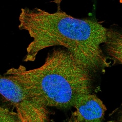 Invitrogen STK16 Polyclonal Antibody 100 &mu;L; Unconjugated:Antibodies,