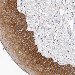 Invitrogen STK16 Polyclonal Antibody 100 &mu;L; Unconjugated:Antibodies,