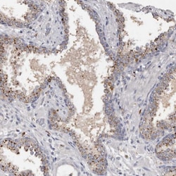 Invitrogen DAP Polyclonal Antibody 100 &mu;L; Unconjugated:Antibodies,