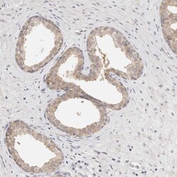 GGPS1 Polyclonal Antibody:Antibodies, Polyclonal