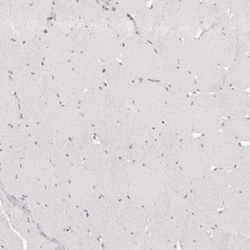 GGPS1 Polyclonal Antibody:Antibodies, Polyclonal
