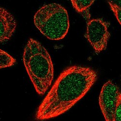 Invitrogen CHML Polyclonal Antibody 100 &mu;L; Unconjugated:Antibodies,