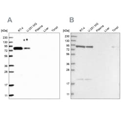 Invitrogen CHML Polyclonal Antibody 100 &mu;L; Unconjugated:Antibodies,