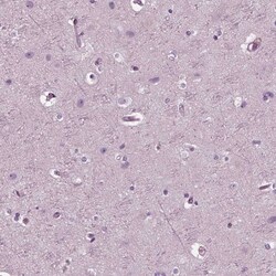 Invitrogen CGA Polyclonal Antibody 100 &mu;L | Buy Online | Invitrogen&trade; | Fisher Scientific
