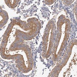 Invitrogen APEH Polyclonal Antibody 100 &mu;L; Unconjugated:Antibodies,