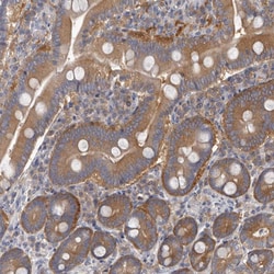 Invitrogen APEH Polyclonal Antibody 100 &mu;L; Unconjugated:Antibodies,