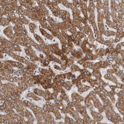Invitrogen ALDH5A1 Polyclonal Antibody 100 &mu;L; Unconjugated:Antibodies,