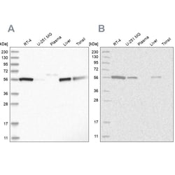 Invitrogen ALDH5A1 Polyclonal Antibody 100 &mu;L; Unconjugated:Antibodies,