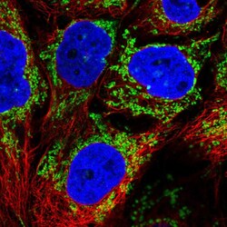 ALDH5A1 Polyclonal Antibody:Antibodies, Polyclonal