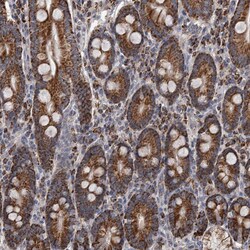 ALDH5A1 Polyclonal Antibody:Antibodies, Polyclonal
