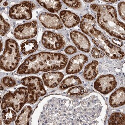 ALDH5A1 Polyclonal Antibody:Antibodies, Polyclonal
