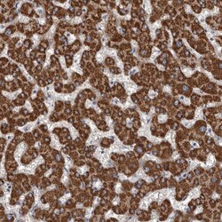 ALDH5A1 Polyclonal Antibody:Antibodies, Polyclonal