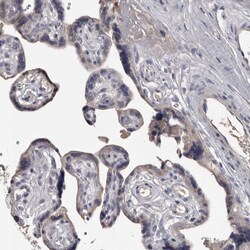 ALDH5A1 Polyclonal Antibody:Antibodies, Polyclonal