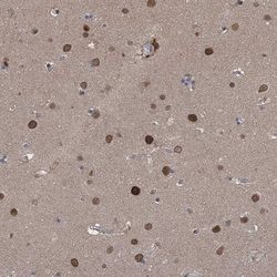Invitrogen KPNB1 Polyclonal Antibody 100 &mu;L; Unconjugated:Antibodies,