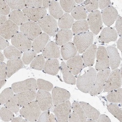 Invitrogen KPNB1 Polyclonal Antibody 100 &mu;L; Unconjugated:Antibodies,