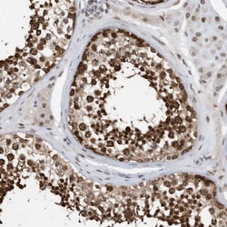 Invitrogen KPNB1 Polyclonal Antibody 100 &mu;L; Unconjugated:Antibodies,