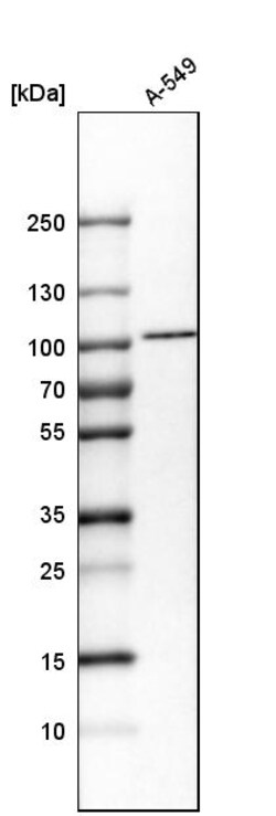 Invitrogen KPNB1 Polyclonal Antibody 100 &mu;L | Buy Online | Invitrogen&trade; | Fisher Scientific