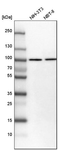 Invitrogen KPNB1 Polyclonal Antibody 100 &mu;L | Buy Online | Invitrogen&trade; | Fisher Scientific