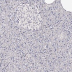 Invitrogen SOX4 Polyclonal Antibody 100 &mu;L; Unconjugated:Antikörper