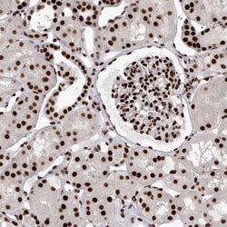 Invitrogen NuMA Polyclonal Antibody 100 &mu;L; Unconjugated:Antibodies,