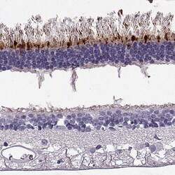 RD3 Polyclonal Antibody:Antibodies, Polyclonal