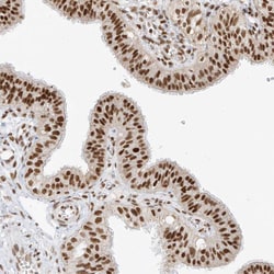 Invitrogen SMARCA2 Polyclonal Antibody 100 &mu;L; Unconjugated:Antibodies,