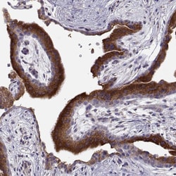 Invitrogen ERO1L Polyclonal Antibody 100 &mu;L; Unconjugated:Antibodies,