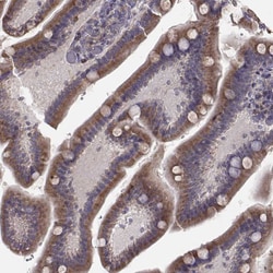 Invitrogen ERO1L Polyclonal Antibody 100 &mu;L; Unconjugated:Antibodies,