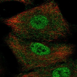 SERPINB9 Polyclonal Antibody:Antibodies, Polyclonal