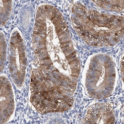 SERPINB9 Polyclonal Antibody:Antibodies, Polyclonal